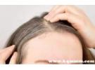 散粉扑头发控油会导致脱发吗，用散粉扑头发会脱发吗