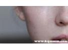 激素脸用什么牌子的护肤品比较好，修复激素脸的护肤品有哪些