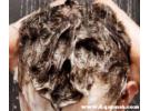 勤洗头发会导致脱发吗，每天都洗头发会不会造成脱发