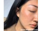 网上祛斑的老师可信吗，网上的祛斑老师是真是假