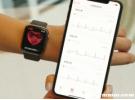 千万不要开启iwatch心电图？手表心电图准吗